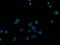 CUB Domain Containing Protein 1 antibody, M02411, Boster Biological Technology, Immunofluorescence image 