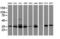 Cytochrome P450 Family 2 Subfamily A Member 6 antibody, LS-C173480, Lifespan Biosciences, Western Blot image 