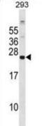 Glutathione Peroxidase 8 (Putative) antibody, abx029040, Abbexa, Western Blot image 