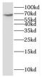 Kelch Repeat And BTB Domain Containing 2 antibody, FNab04475, FineTest, Western Blot image 