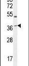 Apolipoprotein L6 antibody, PA5-23622, Invitrogen Antibodies, Western Blot image 