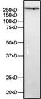 Filamin A antibody, MA5-11705, Invitrogen Antibodies, Western Blot image 