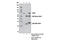 Dihydrolipoamide S-Acetyltransferase antibody, 12362S, Cell Signaling Technology, Immunoprecipitation image 