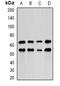 PDZ And LIM Domain 5 antibody, orb381947, Biorbyt, Western Blot image 