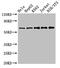 Cleavage And Polyadenylation Specific Factor 6 antibody, CSB-PA621966LA01HU, Cusabio, Western Blot image 