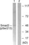 SMAD Family Member 3 antibody, LS-C199587, Lifespan Biosciences, Western Blot image 
