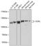 OCRL Inositol Polyphosphate-5-Phosphatase antibody, GTX64567, GeneTex, Western Blot image 