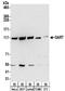 Phosphoribosylglycinamide Formyltransferase, Phosphoribosylglycinamide Synthetase, Phosphoribosylaminoimidazole Synthetase antibody, NBP2-32206, Novus Biologicals, Western Blot image 