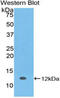 S100 Calcium Binding Protein A5 antibody, MBS2001324, MyBioSource, Western Blot image 