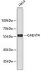 Polypeptide N-Acetylgalactosaminyltransferase 4 antibody, 19-318, ProSci, Western Blot image 