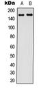 CF Transmembrane Conductance Regulator antibody, LS-C354609, Lifespan Biosciences, Western Blot image 