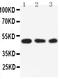 Serum/Glucocorticoid Regulated Kinase 1 antibody, PA2184, Boster Biological Technology, Western Blot image 