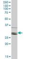 Chloride Intracellular Channel 2 antibody, H00001193-B02P, Novus Biologicals, Western Blot image 