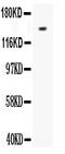 Fms Related Tyrosine Kinase 1 antibody, LS-C343906, Lifespan Biosciences, Western Blot image 