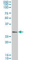 Glutamate-Cysteine Ligase Modifier Subunit antibody, LS-C197305, Lifespan Biosciences, Western Blot image 