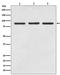 Signal Transducer And Activator Of Transcription 5A antibody, M01087, Boster Biological Technology, Western Blot image 