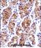 General Transcription Factor IIE Subunit 1 antibody, PA5-48693, Invitrogen Antibodies, Immunohistochemistry paraffin image 