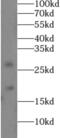 Collagen Type XVIII Alpha 1 Chain antibody, FNab02762, FineTest, Western Blot image 