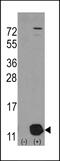 Phosphohistidine Phosphatase 1 antibody, 61-451, ProSci, Western Blot image 