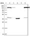 SPT16 Homolog, Facilitates Chromatin Remodeling Subunit antibody, NBP2-38607, Novus Biologicals, Western Blot image 