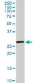 Hydroxysteroid 17-Beta Dehydrogenase 8 antibody, LS-C198512, Lifespan Biosciences, Western Blot image 