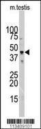 Actin Alpha 1, Skeletal Muscle antibody, MBS9212446, MyBioSource, Western Blot image 