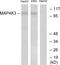 Mitogen-Activated Protein Kinase Kinase Kinase Kinase 3 antibody, LS-C119131, Lifespan Biosciences, Western Blot image 