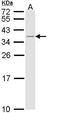 HLA class II histocompatibility antigen, DRB1-15 beta chain antibody, GTX113459, GeneTex, Western Blot image 