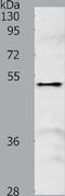 Sperm Associated Antigen 4 antibody, TA322906, Origene, Western Blot image 