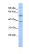 Lymphocyte Specific Protein 1 antibody, orb331552, Biorbyt, Western Blot image 