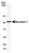Mucolipin 1 antibody, PA1-46474, Invitrogen Antibodies, Western Blot image 
