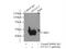 Dynein Axonemal Assembly Factor 4 antibody, 14522-1-AP, Proteintech Group, Immunoprecipitation image 