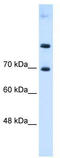 Solute Carrier Family 7 Member 4 antibody, TA333980, Origene, Western Blot image 