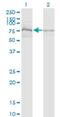 Zinc Finger DHHC-Type Containing 8 antibody, H00029801-M02, Novus Biologicals, Western Blot image 