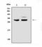 Programmed Cell Death 10 antibody, A01879-1, Boster Biological Technology, Western Blot image 