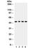 C-Terminal Binding Protein 1 antibody, R32212, NSJ Bioreagents, Western Blot image 
