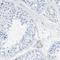 Microtubule Associated Protein RP/EB Family Member 2 antibody, HPA016739, Atlas Antibodies, Immunohistochemistry frozen image 