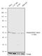 Integrin Linked Kinase antibody, 711291, Invitrogen Antibodies, Western Blot image 