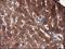 Adenylosuccinate Lyase antibody, M03732, Boster Biological Technology, Immunohistochemistry paraffin image 