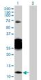 Chibby Family Member 1, Beta Catenin Antagonist antibody, H00025776-D01P, Novus Biologicals, Western Blot image 