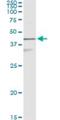 Keratin 17 antibody, H00003872-M01, Novus Biologicals, Immunoprecipitation image 