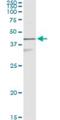 Keratin-17 antibody, H00003872-M01, Novus Biologicals, Immunoprecipitation image 