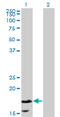 Calmodulin Like 5 antibody, LS-C134076, Lifespan Biosciences, Western Blot image 