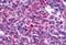 Nuclear Receptor Subfamily 4 Group A Member 3 antibody, MBS243162, MyBioSource, Immunohistochemistry paraffin image 