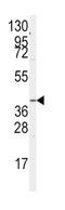 G Protein Subunit Alpha 12 antibody, abx033835, Abbexa, Western Blot image 