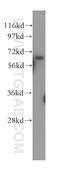 Protein Phosphatase 2 Scaffold Subunit Aalpha antibody, 15882-1-AP, Proteintech Group, Western Blot image 