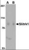 SLIT And NTRK Like Family Member 1 antibody, orb88747, Biorbyt, Western Blot image 