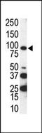 AXL Receptor Tyrosine Kinase antibody, PA5-14567, Invitrogen Antibodies, Western Blot image 