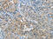 Protein Kinase C Alpha antibody, CSB-PA105506, Cusabio, Immunohistochemistry paraffin image 