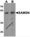 SAM Domain, SH3 Domain And Nuclear Localization Signals 1 antibody, 7079, ProSci, Western Blot image 